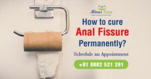 Read more about the article How to cure anal fissure permanently – Home remedies and Surgical Treatment?