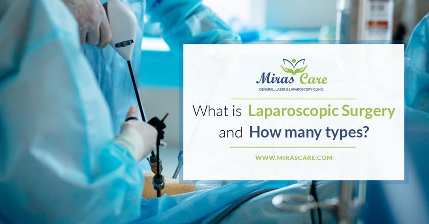 Read more about the article What is Laparoscopic Surgery and Types of Laparoscopic Treatment