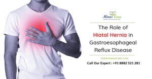 Read more about the article What is the role of Hiatal Hernia in Gastroesophageal Reflux Disease [GERD]