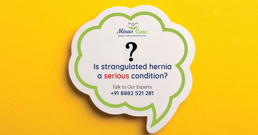 Read more about the article Is strangulated hernia a serious condition?