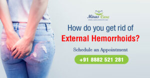 Read more about the article How do you get rid of external hemorrhoids?