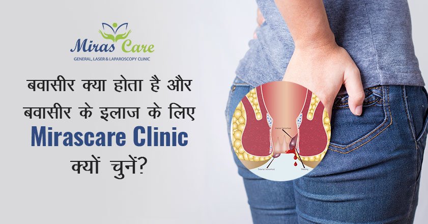 Read more about the article बवासीर क्या होता है और बवासीर के इलाज के लिए  Mirascare Clinic क्यों चुनें?