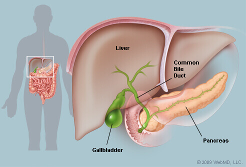 gall bladder stone